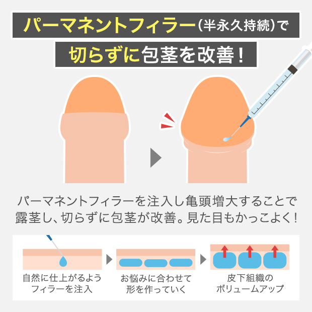 パーネントフィラーで切らずに包茎を改善