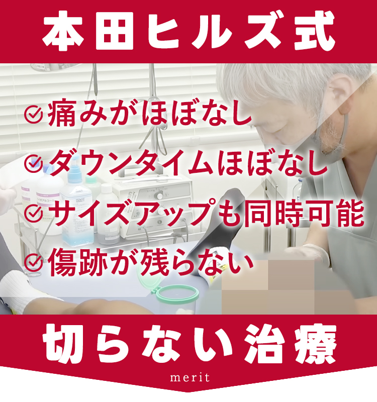 本田ヒルズ式切らない治療のメリット