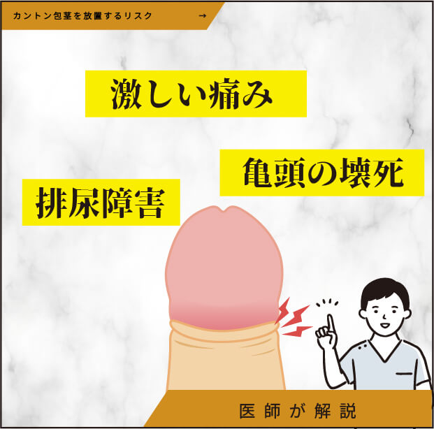カントン包茎を放置するリスク