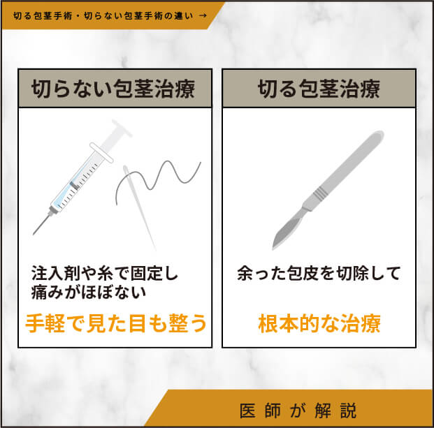 切る包茎手術・切らない包茎手術の違い