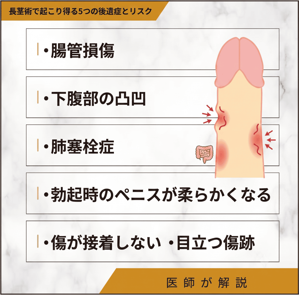 長茎術で起こり得る5つの後遺症とリスク