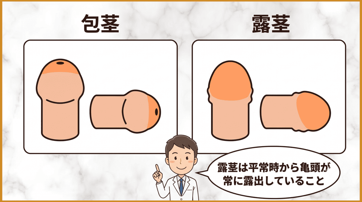 露茎とは？包茎との違いをわかりやすく解説