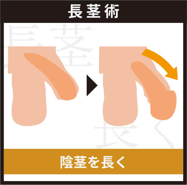 長茎術