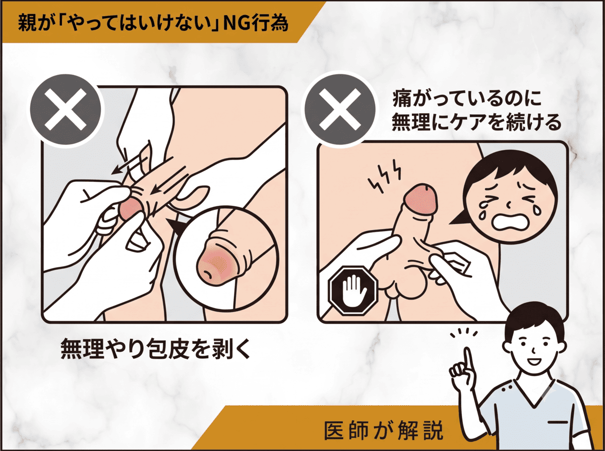 包茎の子どもに親が「やってはいけない」NG行為