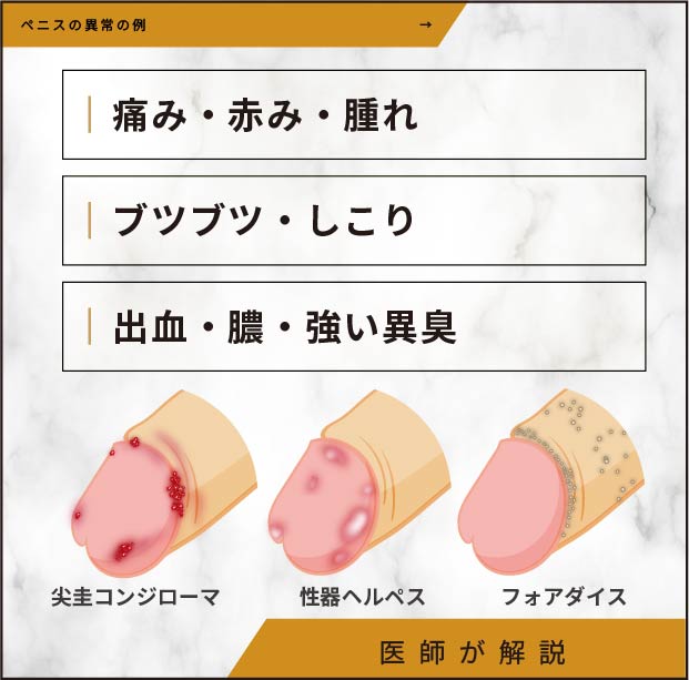 ペニスの異常の例