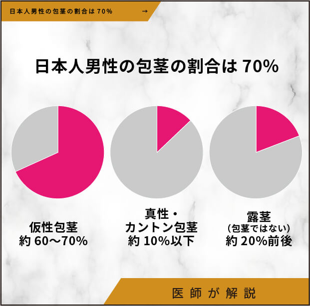 日本人の約7割が仮性包茎とされる現状