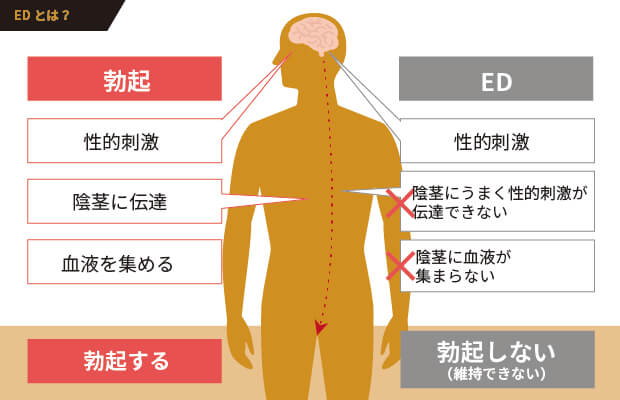 ED（勃起不全）とは？