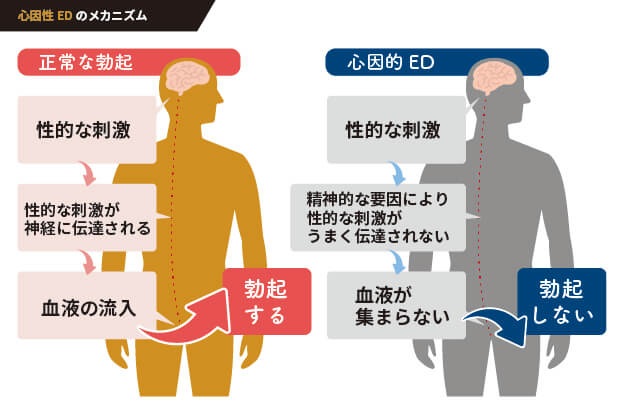 ED（勃起不全）のメカニズム