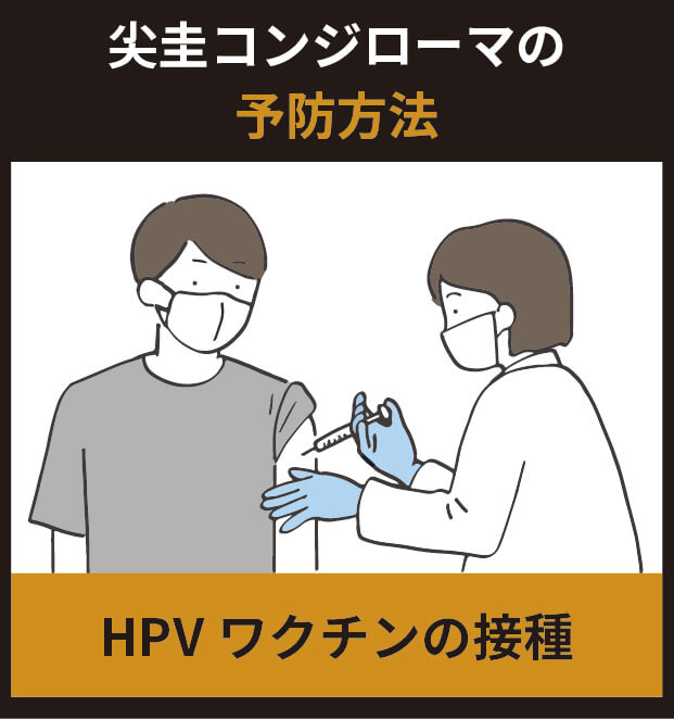 尖圭コンジローマの予防法