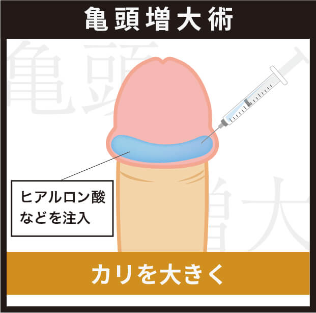 亀頭増大とは?