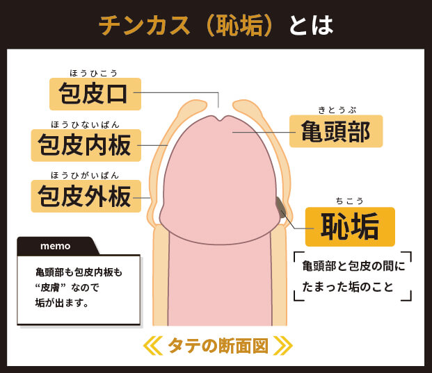 チンカス（恥垢）とは？
