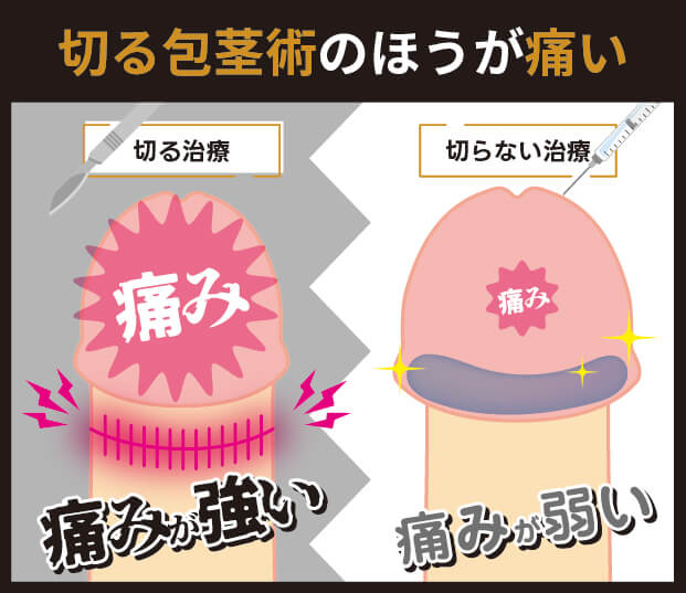切る包茎術のほうが痛い