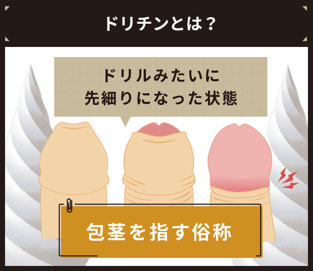 ドリチンとは？