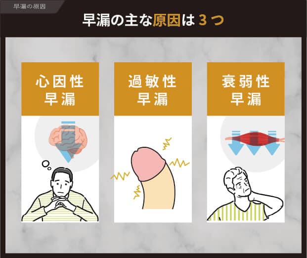 早漏の主な原因3つ