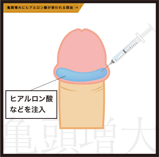 亀頭増大にヒアルロン酸が使われる理由