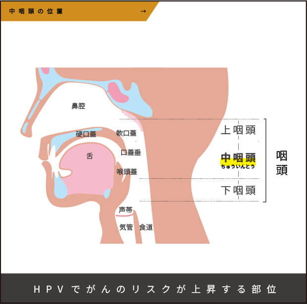 HPVでがんリスクが上昇する部位