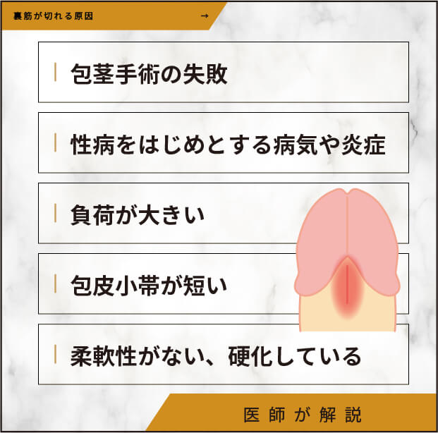 裏筋が切れる理由