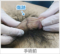 【症例013】長茎術（術前）①