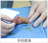 【症例013】長茎術（術後）③