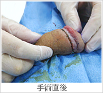 【症例013】長茎術（術後）①