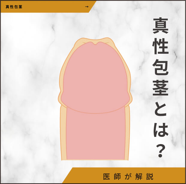 真性包茎とは