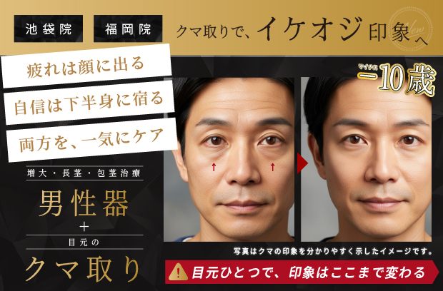 クマ取りでイケオジ印象へ