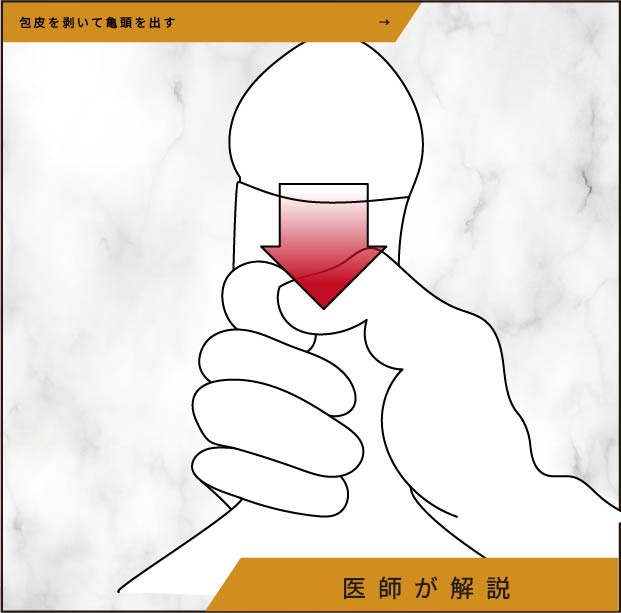 包皮を剥いて亀頭を出す