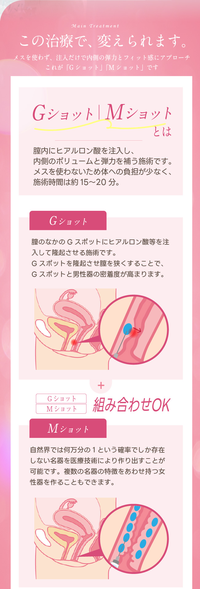 治療の方法