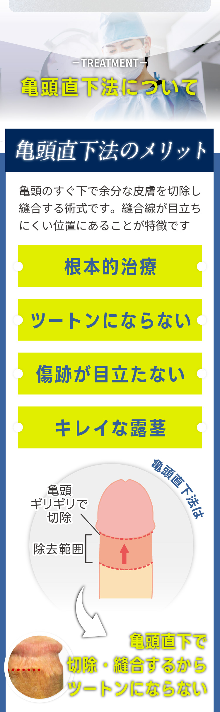 亀頭直下法のメリットは？｜ツートンにならない。きれいに仕上がる