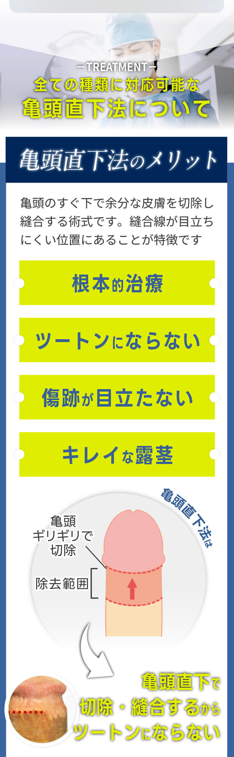 亀頭直下法のメリットは？｜ツートンにならない。きれいに仕上がる