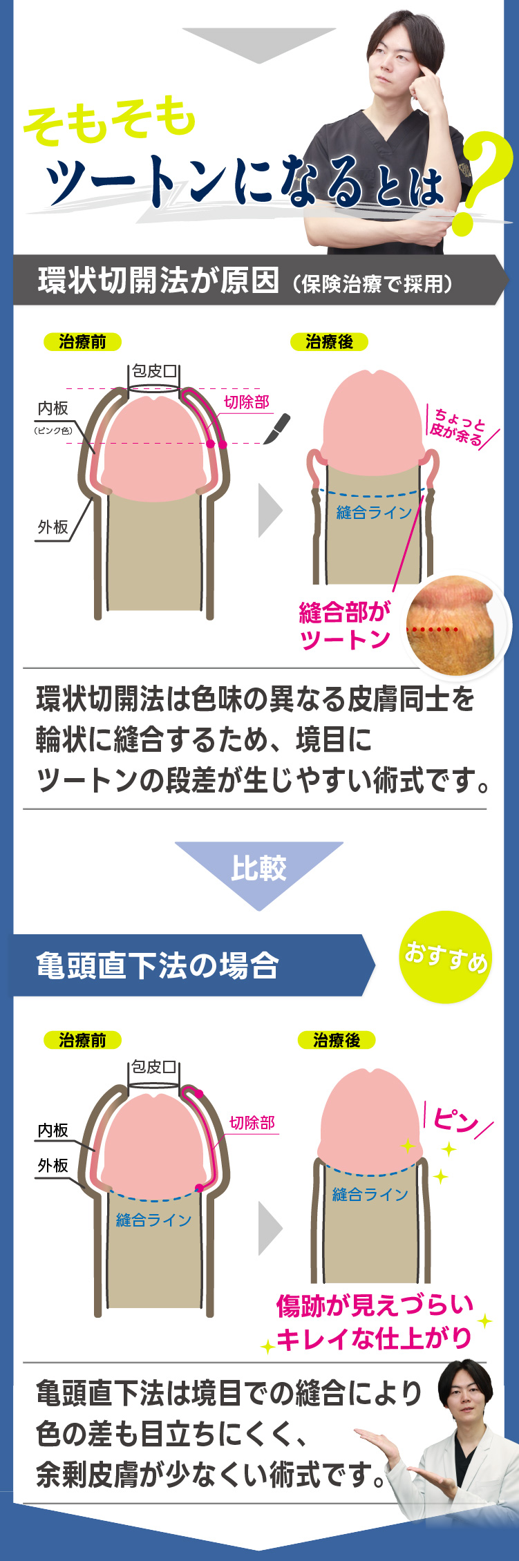 ツートンになるとは？環状切開法が原因