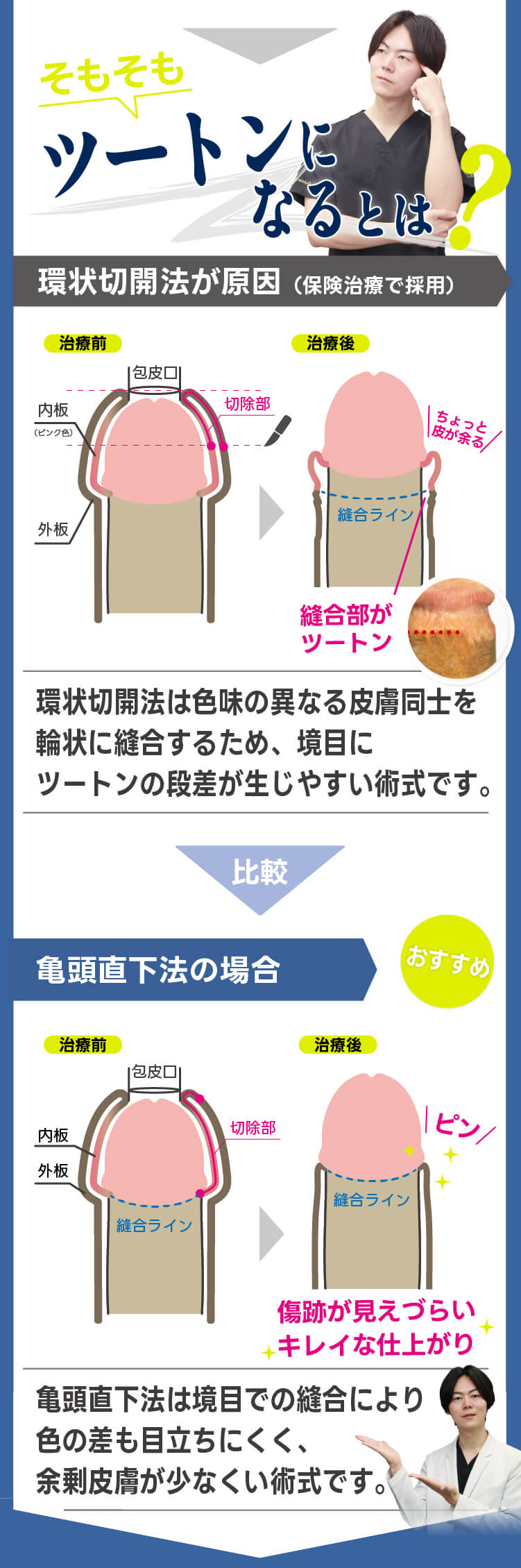 ツートンになるとは？環状切開法が原因