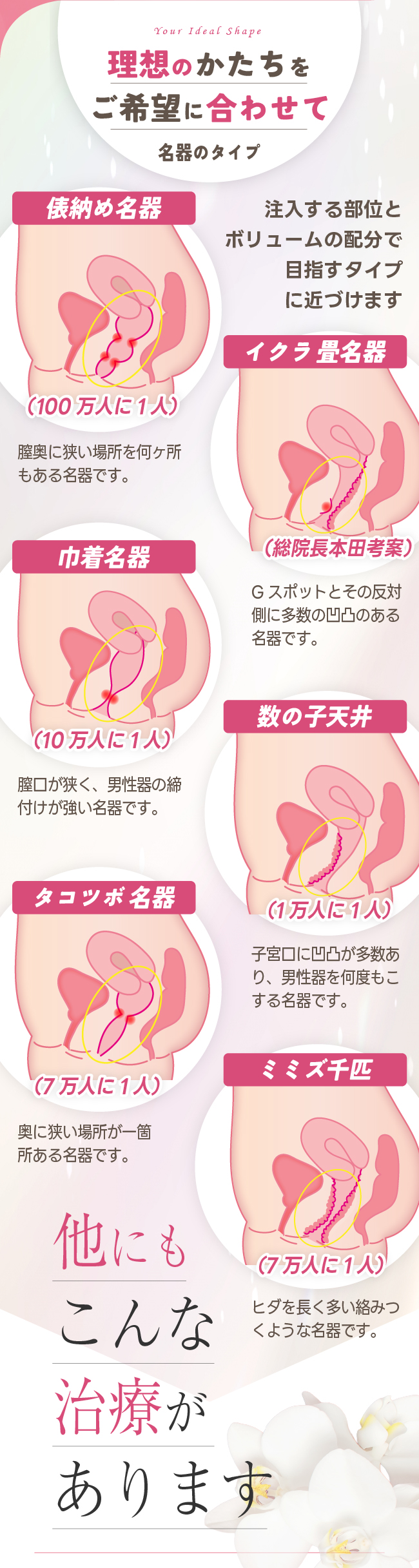 名器の種類