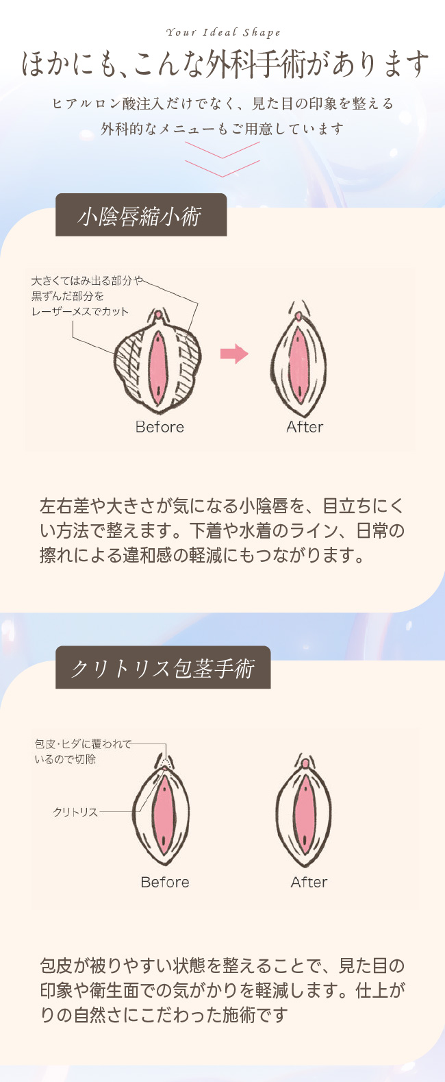 他の外科手術
