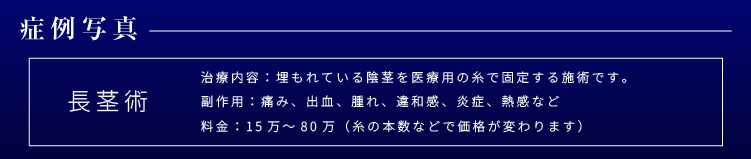 長茎症例のタイトル