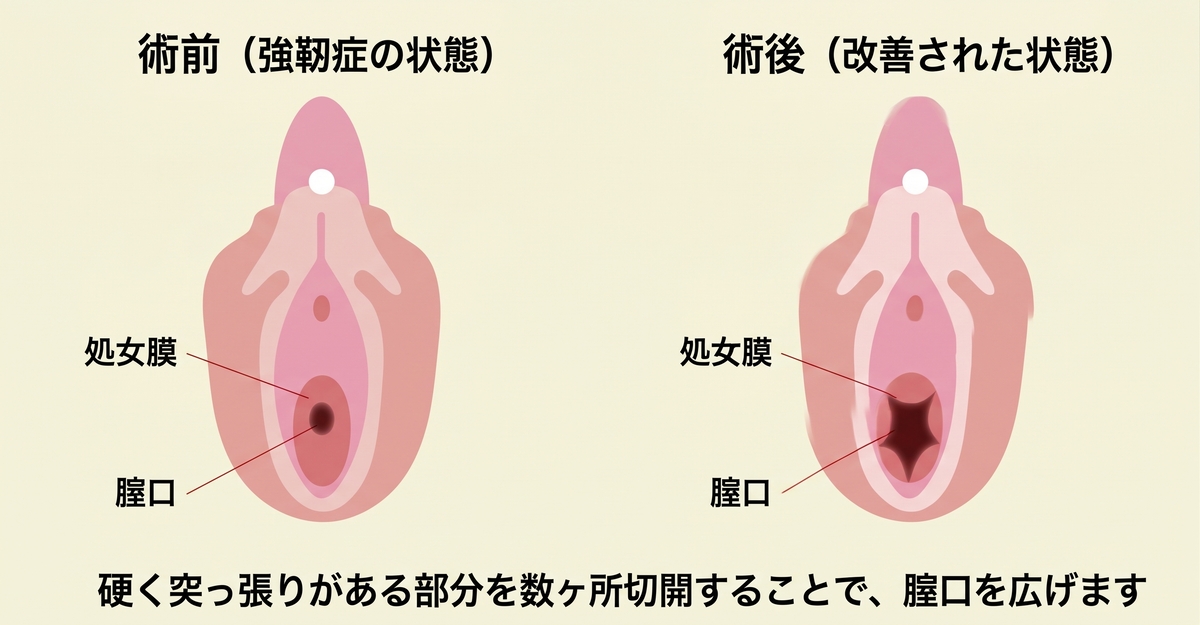 治療方法